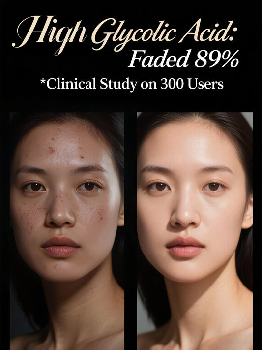 Glycolic Acid Peel Solution – 30ml, Multiple Options