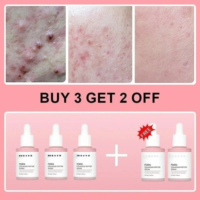 PDRN Collagen Peptide Face Serum β Hydrating Care for Dry, Dull Skin