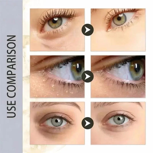 Moisturizing Eye Cream – 30ml, Single & Multipack Options