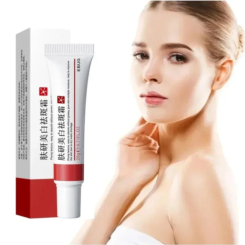 Niacinamide Whitening & Freckle Removal Cream – Dark Spot Corrector, Melasma & Pigmentation Fade (20g)