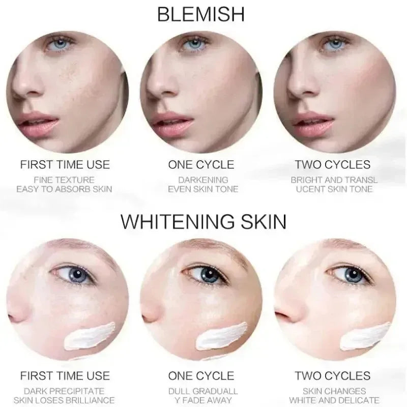 Niacinamide Whitening & Freckle Removal Cream – Dark Spot Corrector, Melasma & Pigmentation Fade (20g)