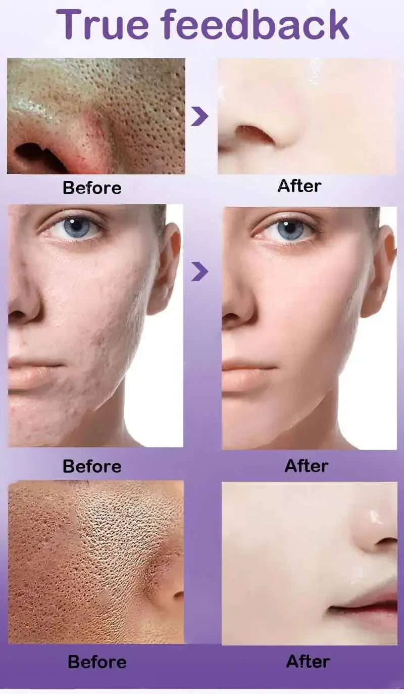 Moisturizing Facial Serum – 10ml, Single & Promotional Options