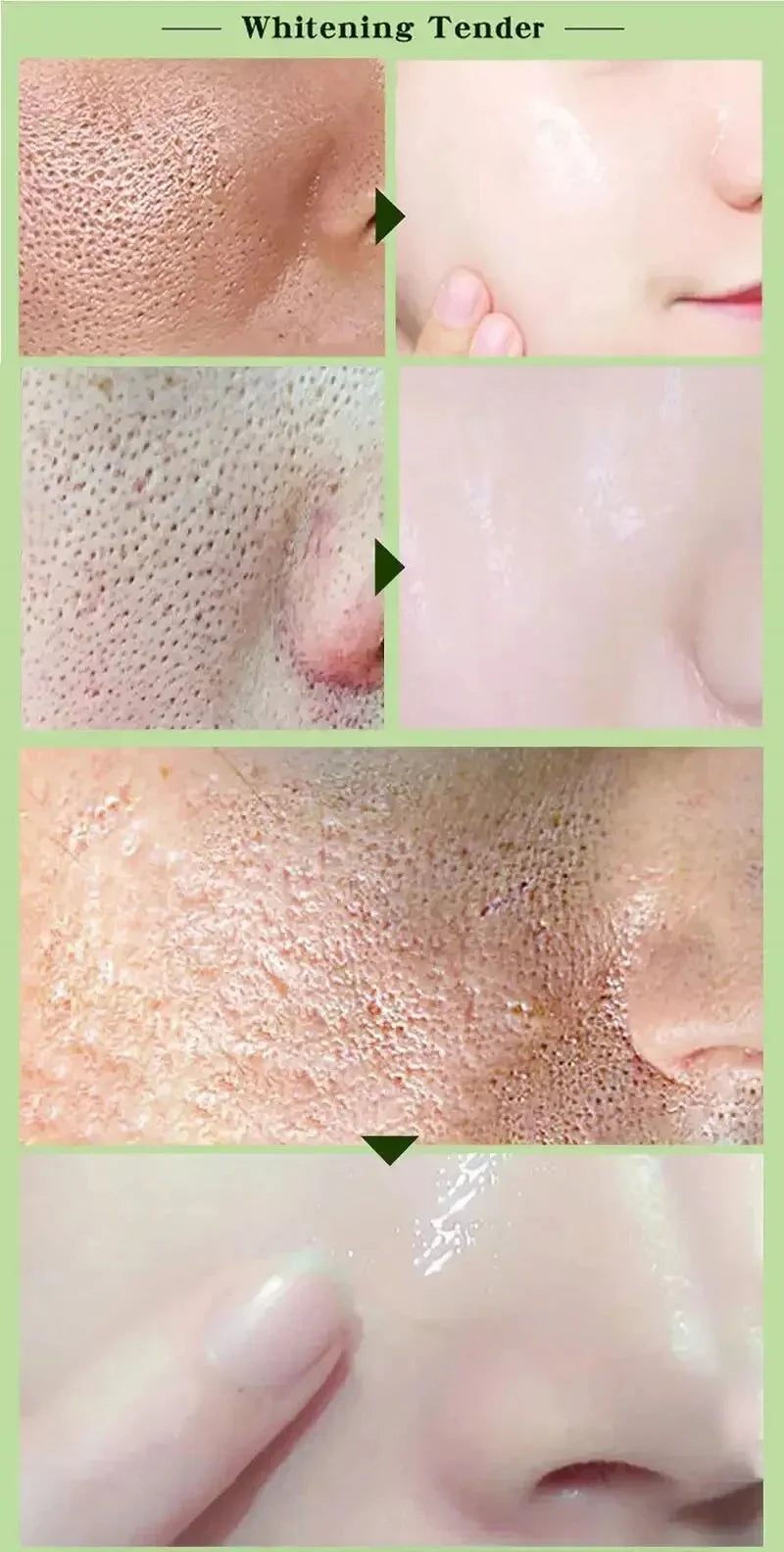 Pore Shrinking Cream Elimination Large Pores Blackehead Remove Acne Pit Repair Gel Tighten Face Smooth Skin Korean Care Products