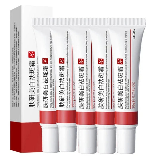 Niacinamide Whitening & Freckle Removal Cream – Dark Spot Corrector, Melasma & Pigmentation Fade (20g)