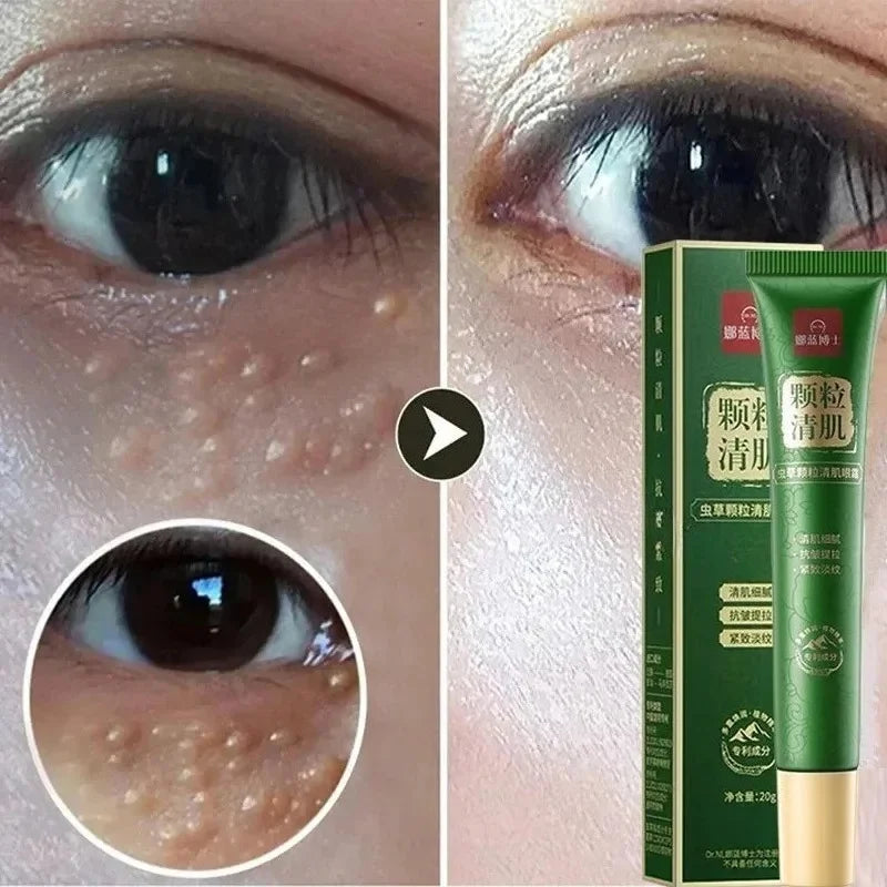 Moisturizing Eye Cream – 30ml, Single & Multipack Options