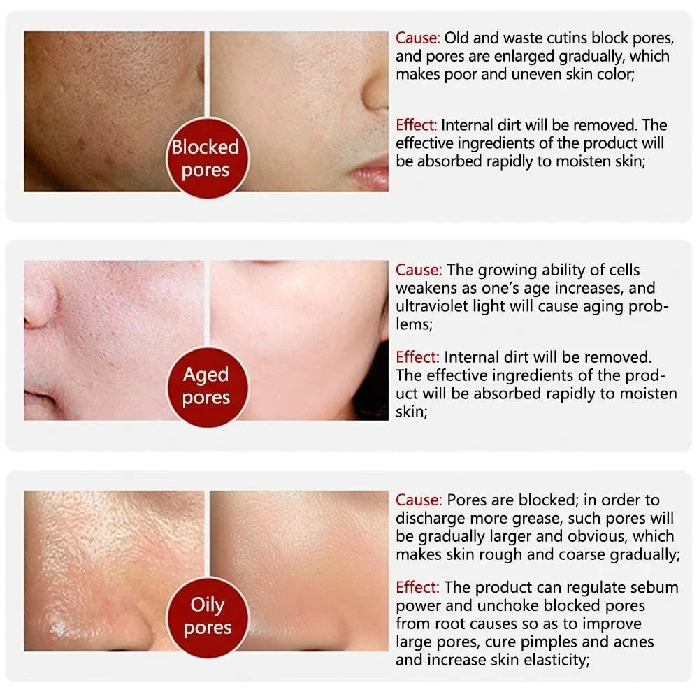 Moisturizing Facial Serum – 10ml, Single & Promotional Options