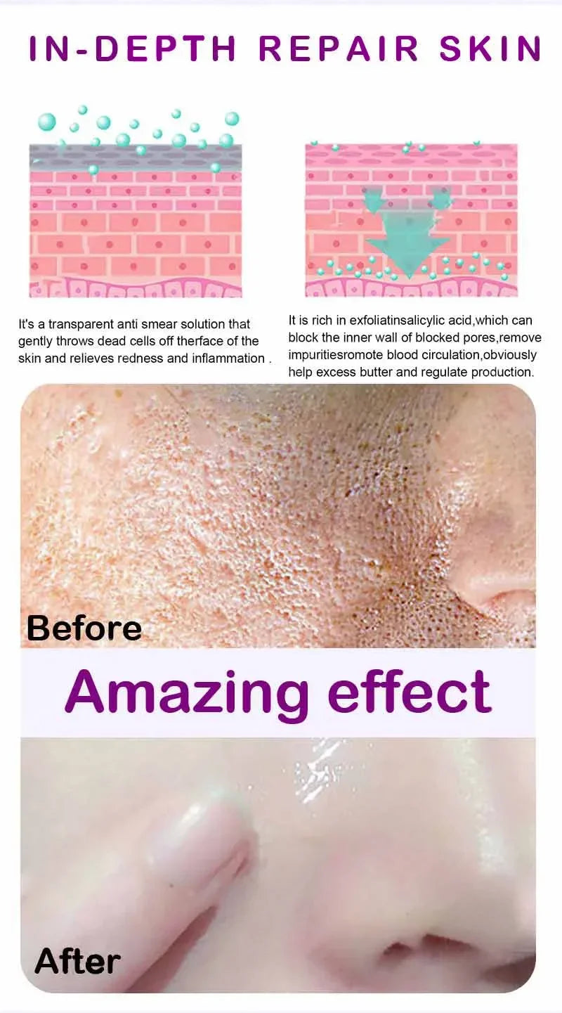 Moisturizing Facial Serum – 10ml, Single & Promotional Options
