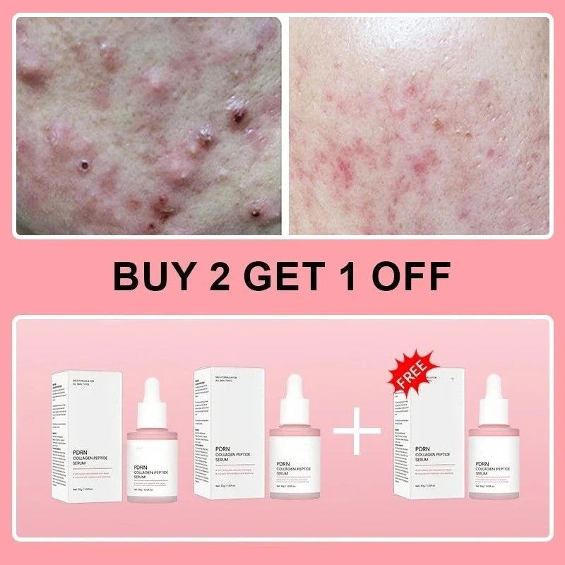 PDRN Collagen Peptide Face Serum – Hydrating Care for Dry, Dull Skin