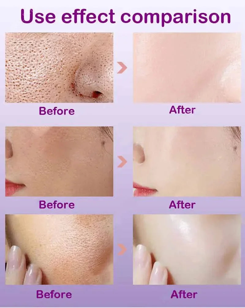 Moisturizing Facial Serum – 10ml, Single & Promotional Options
