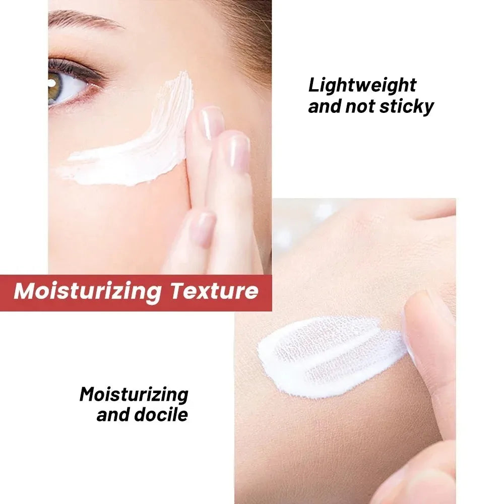 Niacinamide Whitening & Freckle Removal Cream – Dark Spot Corrector, Melasma & Pigmentation Fade (20g)