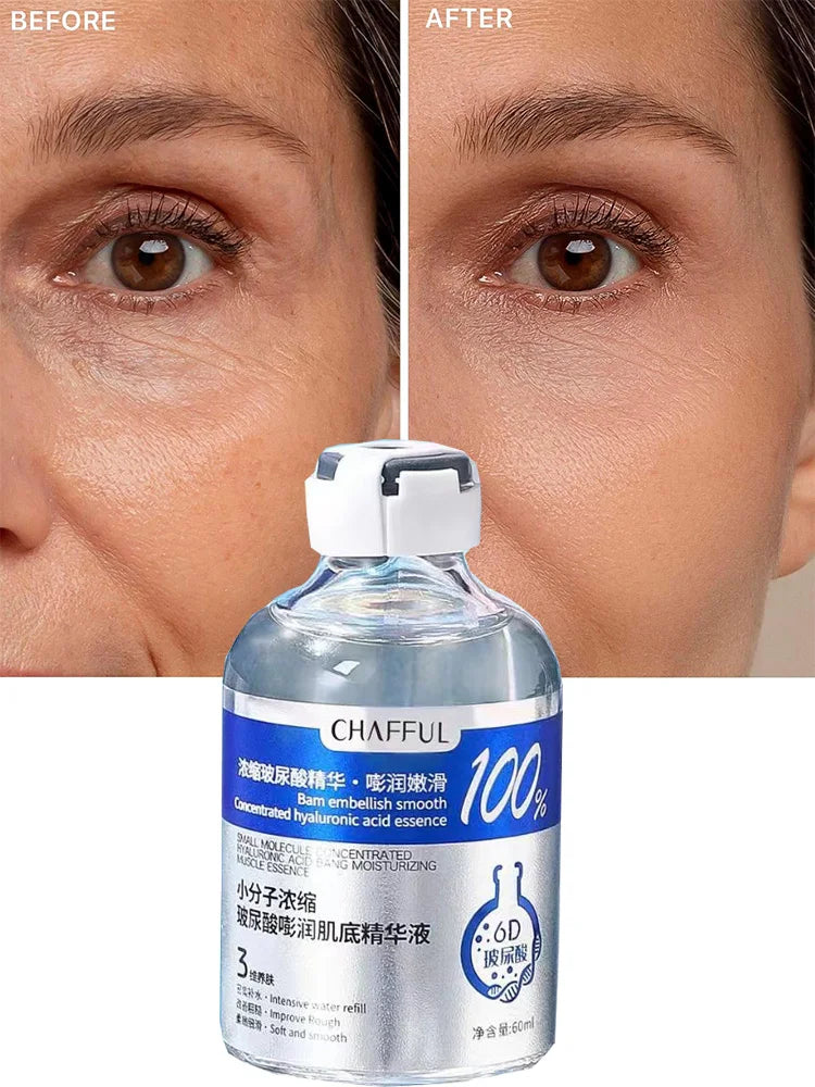 Hyaluronic Acid Deep Moisture Facial Serum – Intense Hydration & Plumping Essence (2x60ml)