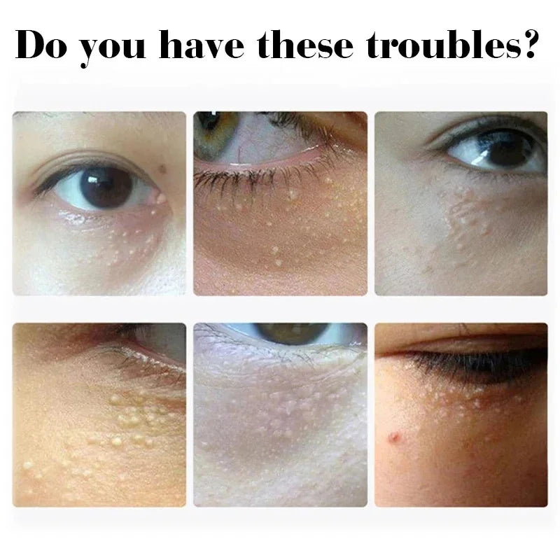 Moisturizing Eye Cream – 30ml, Single & Multipack Options