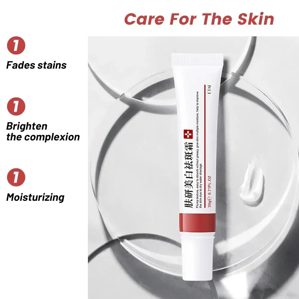 Niacinamide Whitening & Freckle Removal Cream – Dark Spot Corrector, Melasma & Pigmentation Fade (20g)