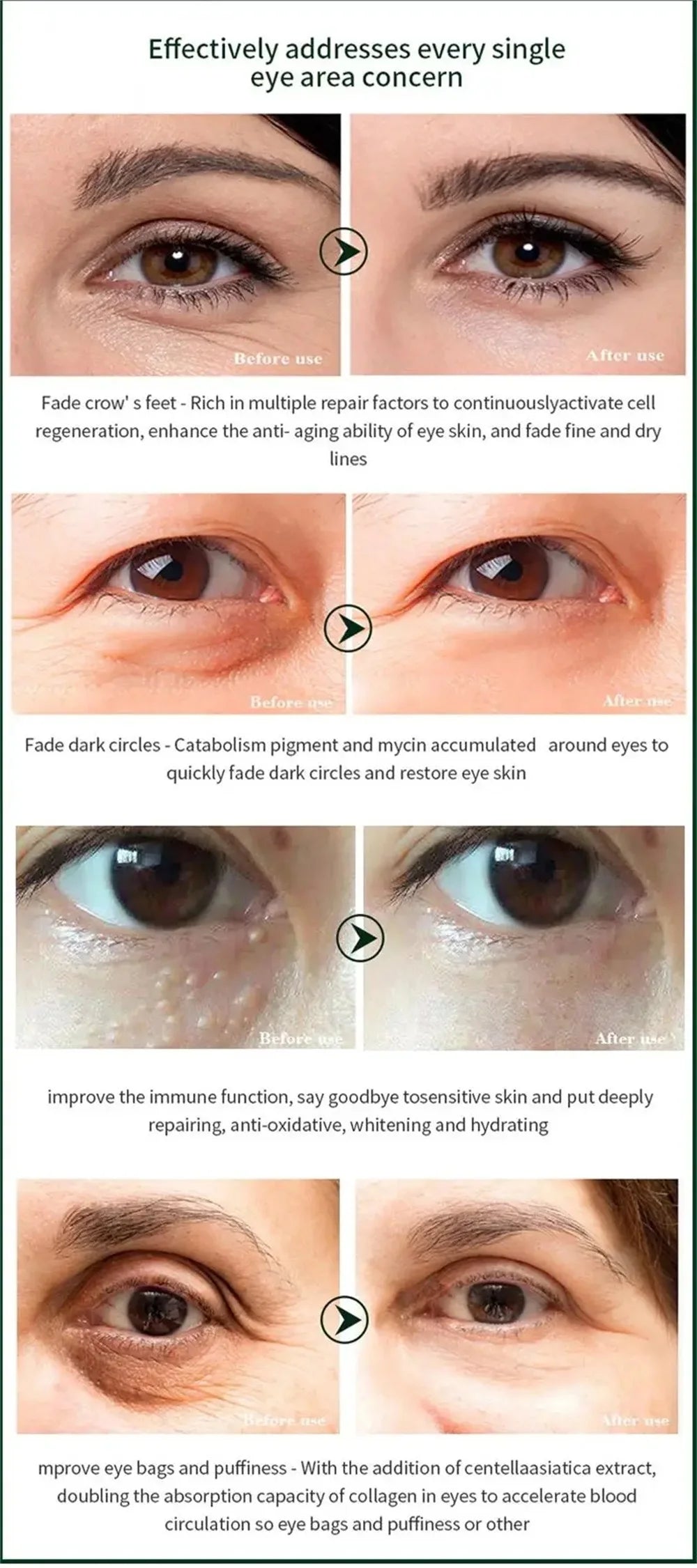 Moisturizing Eye Cream – 30ml, Single & Multipack Options
