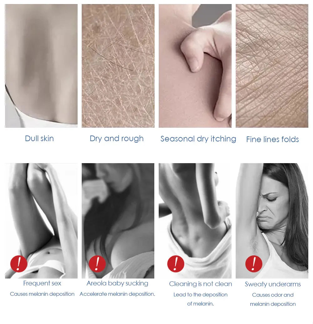 Okeny's Intimate Area & Body Brightening Cream – Underarm, Knee & Inner Thigh Dark Spot Corrector