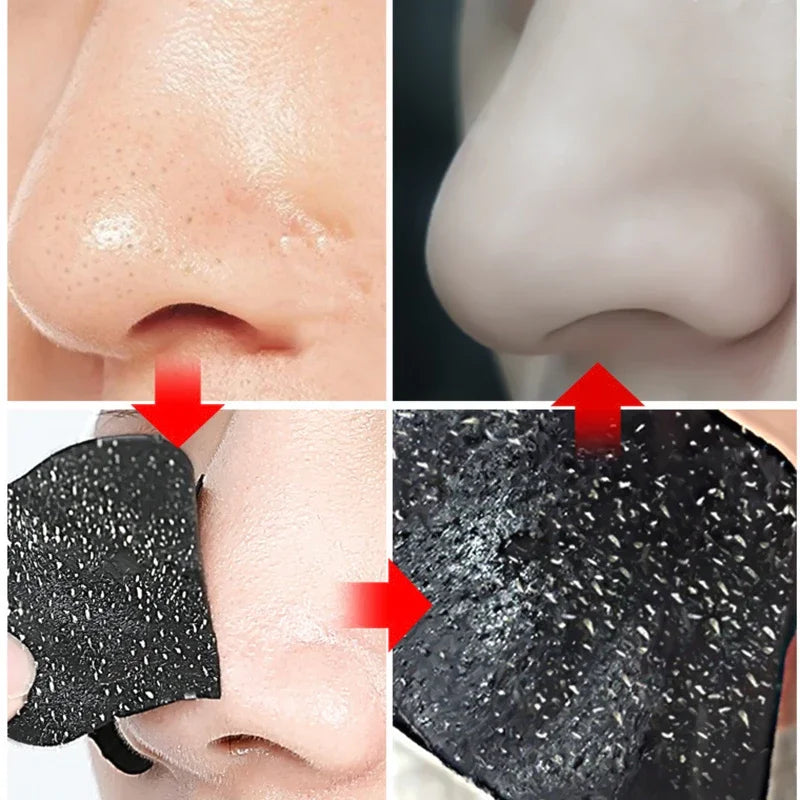 10-50pcs Nose Strips For Blackheads Acne Removal Instant Pore Unclogging Mask Deep Cleansing Nose Clean Patch Beauty Skin Care