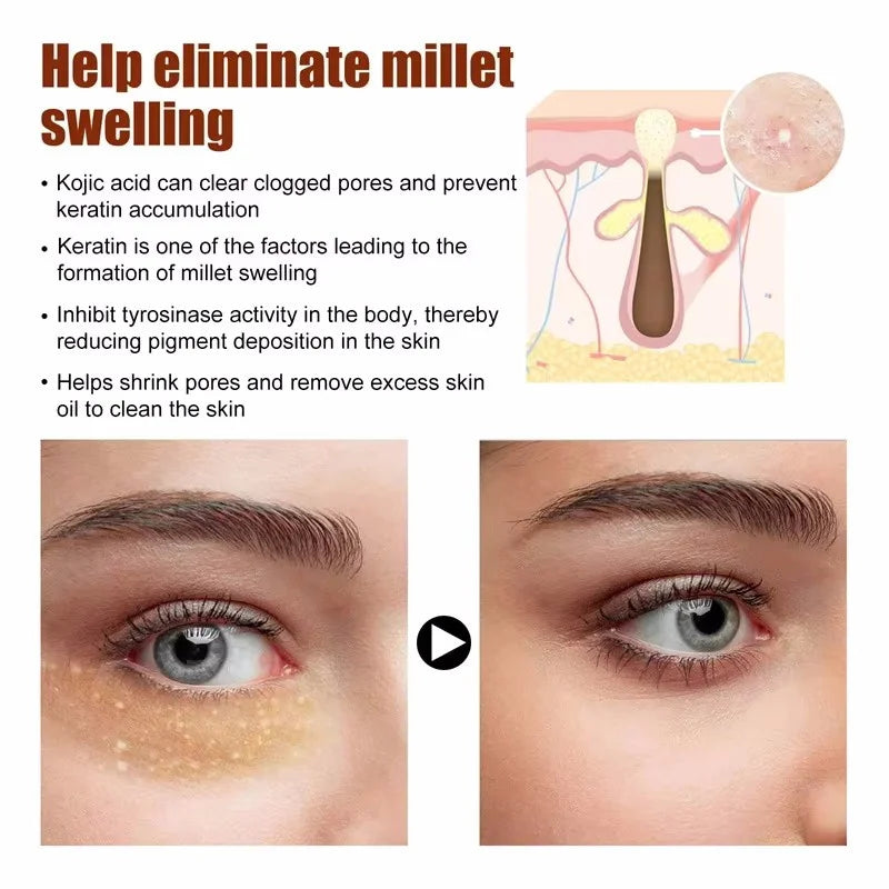 Moisturizing Eye Cream – 30ml, Single & Multipack Options