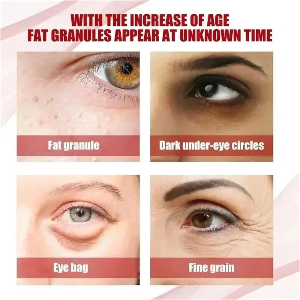 Moisturizing Eye Cream – 30ml, Single & Multipack Options