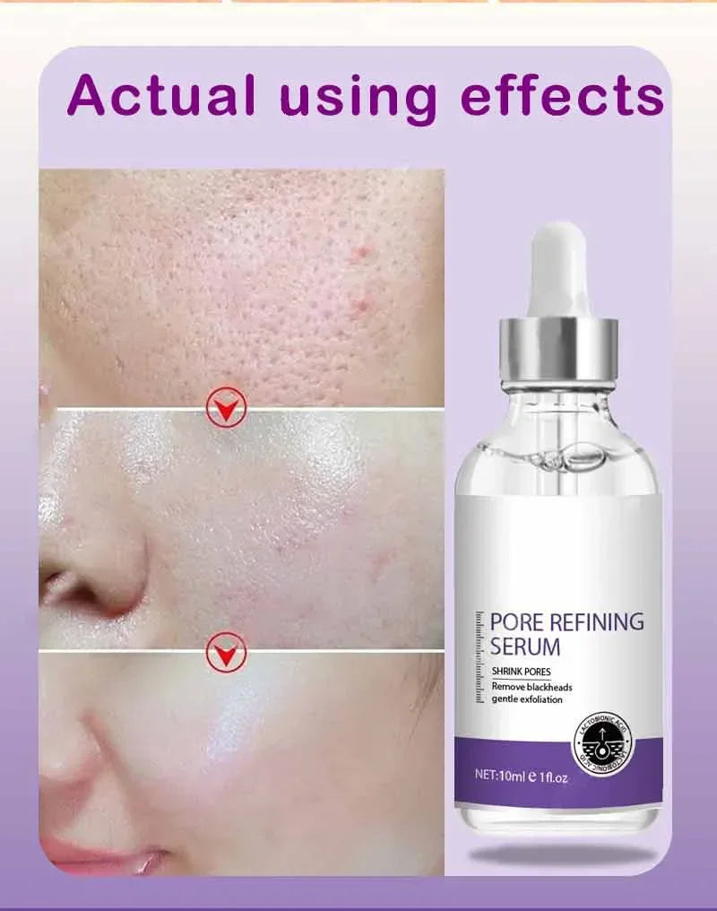 Moisturizing Facial Serum – 10ml, Single & Promotional Options