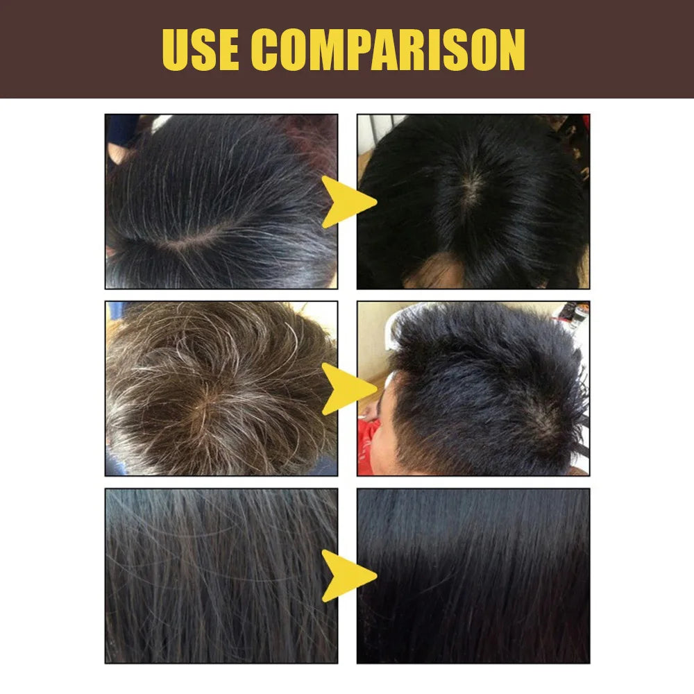 3-in-1 Dark Brown Hair Dye Shampoo – Herbal Gray Coverage, Color & Condition in 15 Minutes | 100ml/200ml