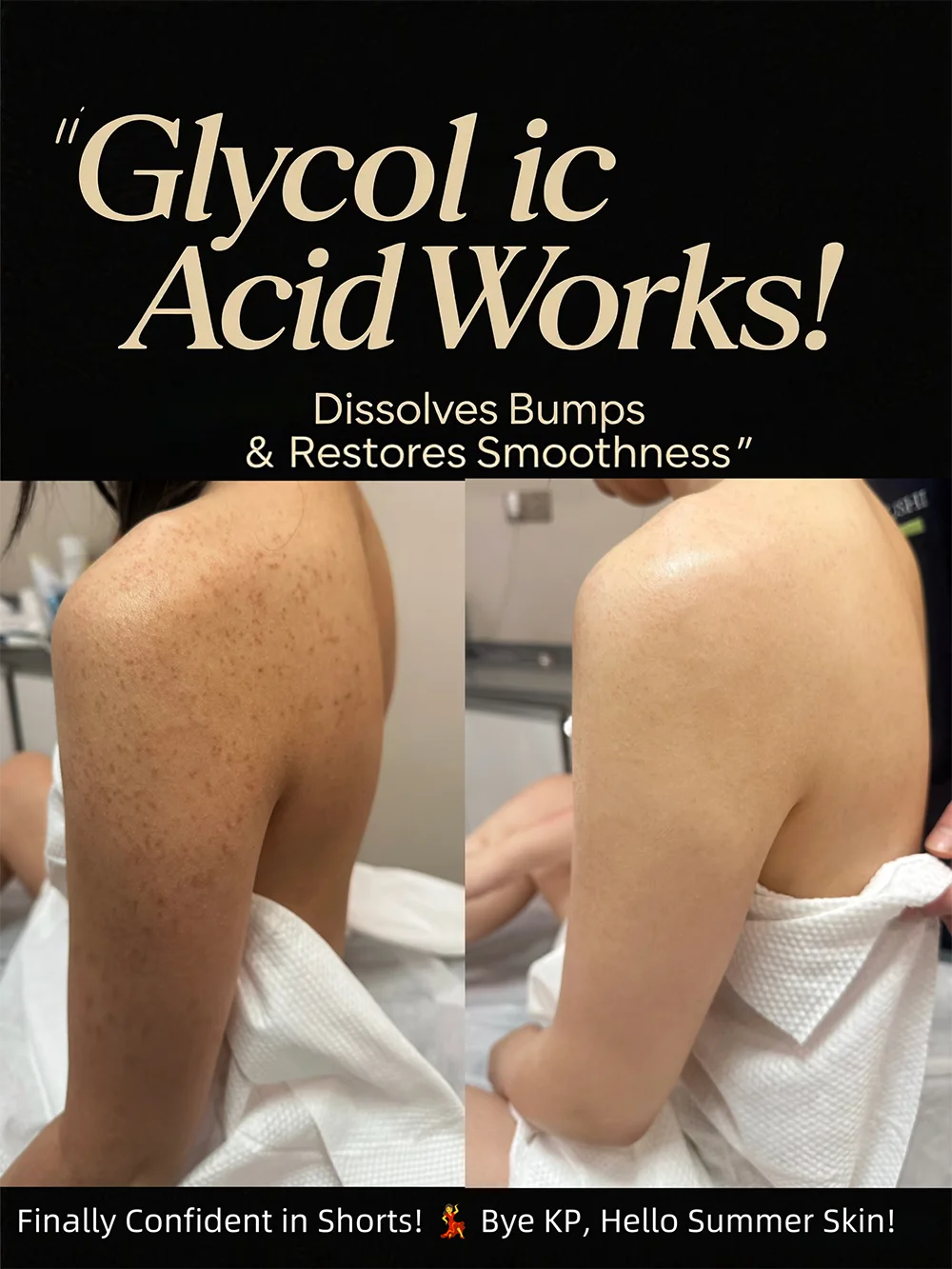 Glycolic Acid Peel Solution – 30ml, Multiple Options