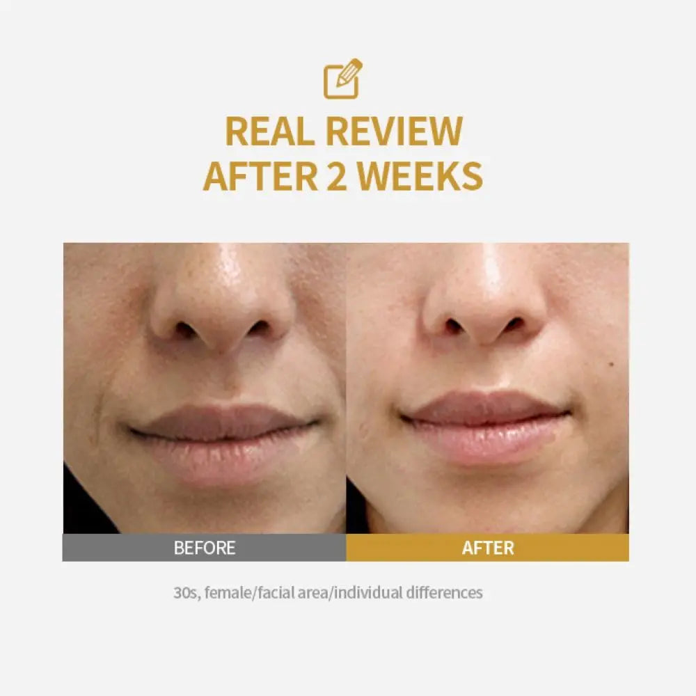 Collagen & Silk Peptide Lifting Ampoule Serum – Anti-Aging Skin Firming & Tightening