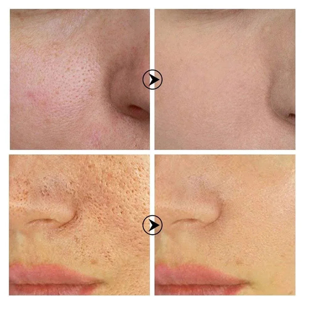 Moisturizing Facial Serum – 10ml, Single & Promotional Options