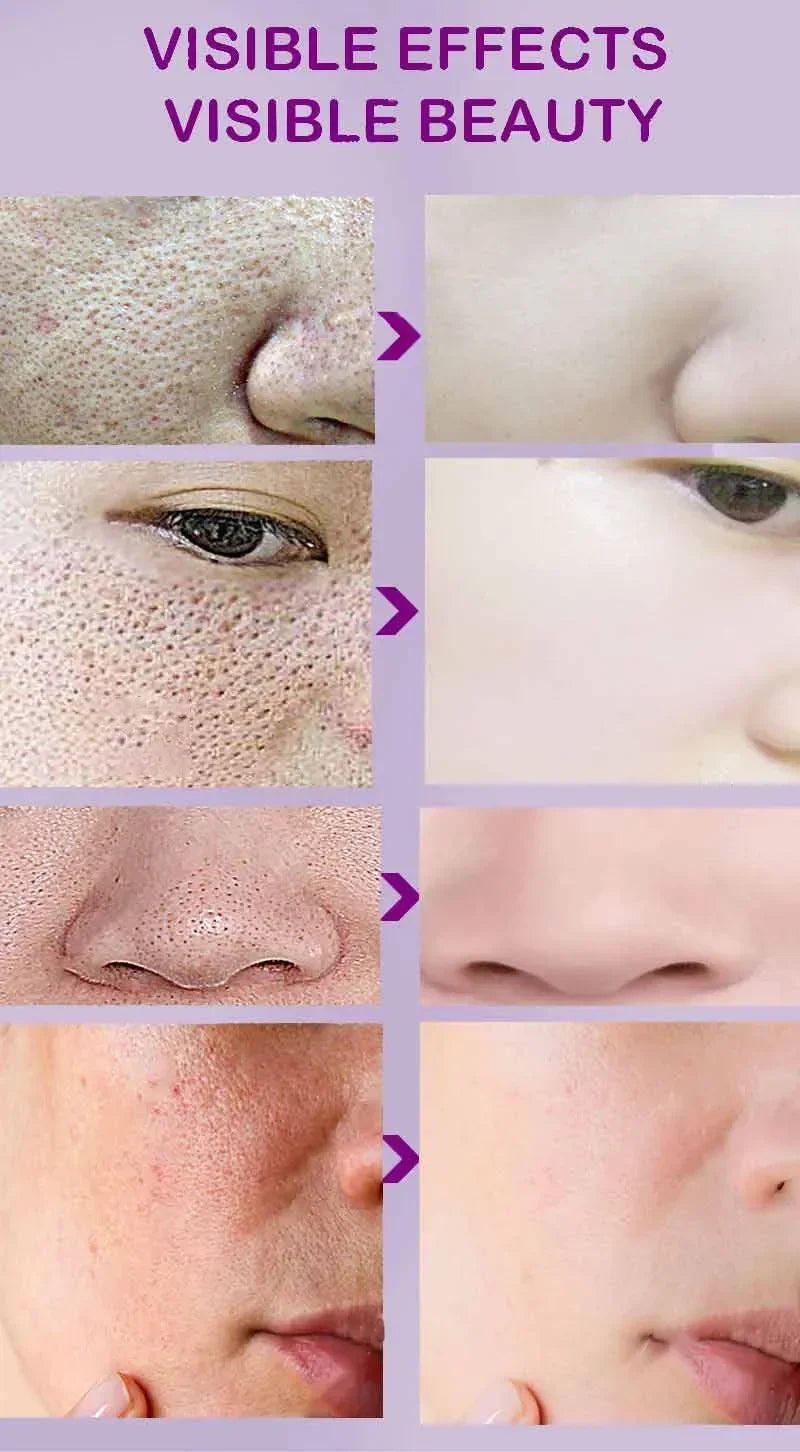 Moisturizing Facial Serum – 10ml, Single & Promotional Options