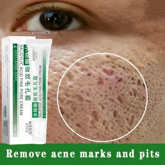 Salicylic Acid Pore Shrinking Cream – Blackhead Removal, Acne Repair & Skin Tightening | Korean Skincare
