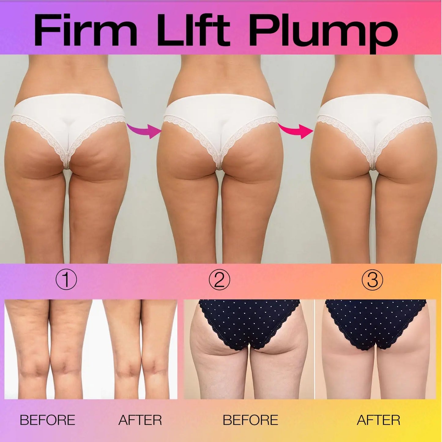 Butt Lift & Firming Cream – Tighten, Tone & Reduce Cellulite on Booty & Thighs (100ml)