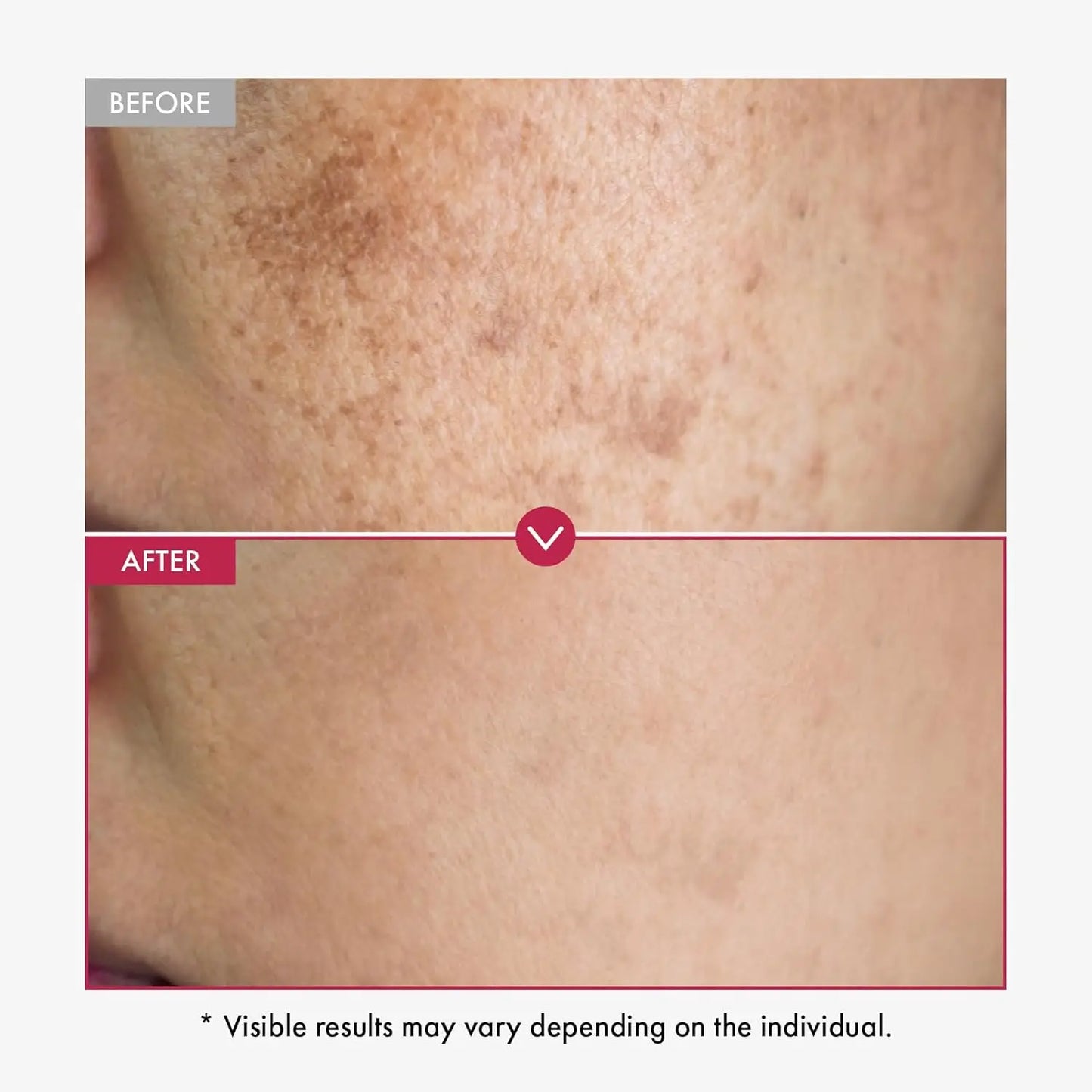 Alpha Arbutin Skin Whitening & Brightening Body Serum – Dark Spot Reduction, Even Tone & Anti-Aging (500ml)