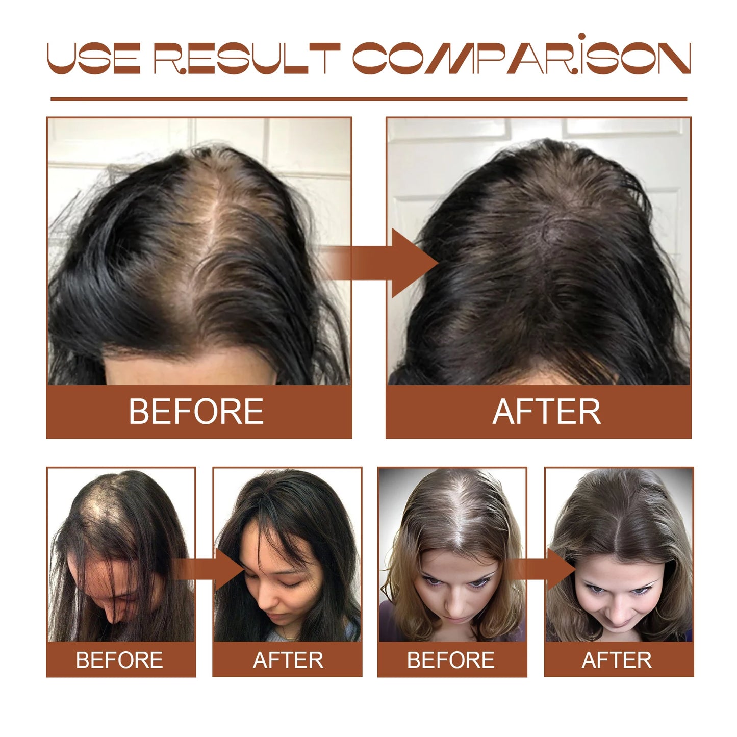 Batana Oil Hair Growth Mask – Organic Treatment for Hair Loss, Breakage & Dry Scalp