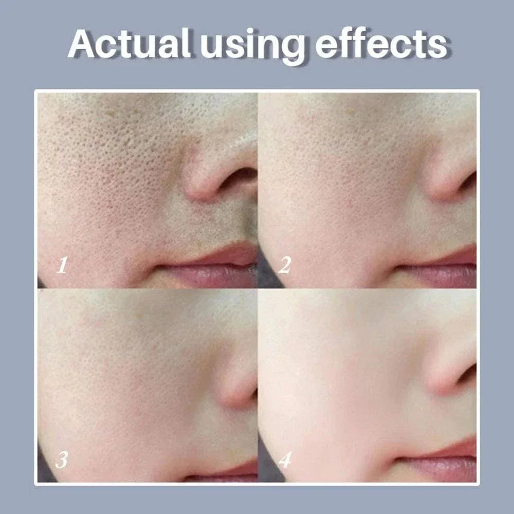 Moisturizing Facial Serum – 10ml, Single & Promotional Options