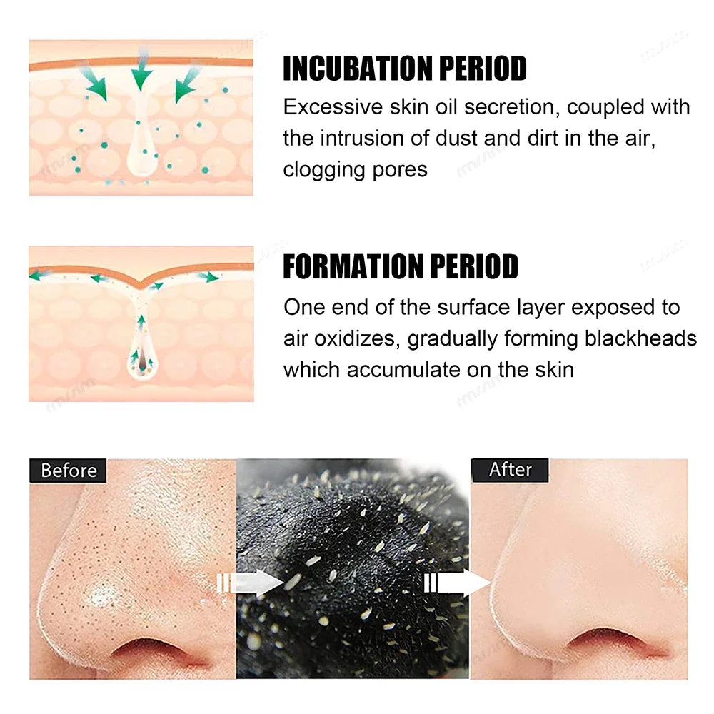 10-50pcs Nose Strips For Blackheads Acne Removal Instant Pore Unclogging Mask Deep Cleansing Nose Clean Patch Beauty Skin Care