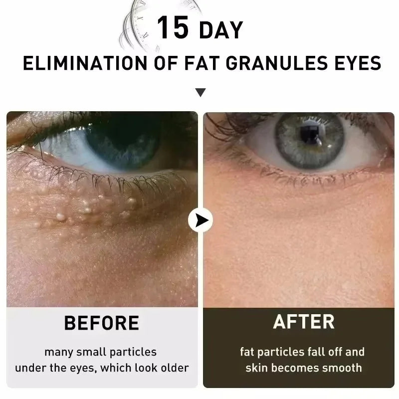 Moisturizing Eye Cream – 30ml, Single & Multipack Options